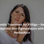 Ayurvedic Treatment for Vitiligo – Restore Natural Skin Pigmentation with HerbalAyur